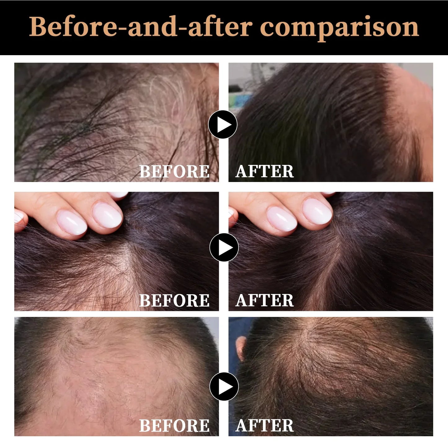 Root Activator Shampoo Fluffy Nourish Care For Thinning Hair Anti Hair Loss Shampoo
