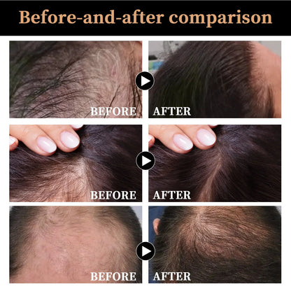Root Activator Shampoo Fluffy Nourish Care For Thinning Hair Anti Hair Loss Shampoo